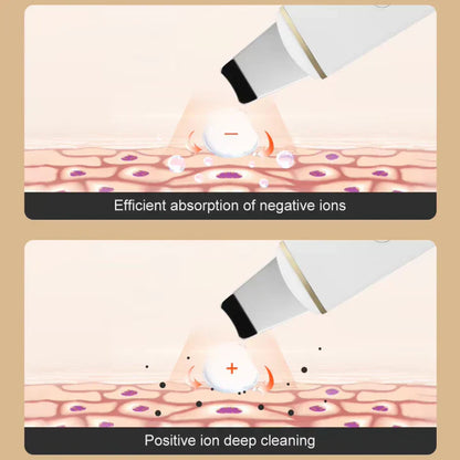 Ultrasonic Facial Skin Scrubber